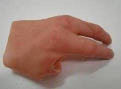 Partial Hand Prosthesis - View Specifications & Details of Silicone ...