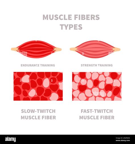 Skeletal muscle fiber types with slow twitch and fast twitch ...