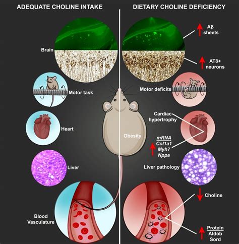 Study explores effects of dietary choline deficiency on neurologic ...