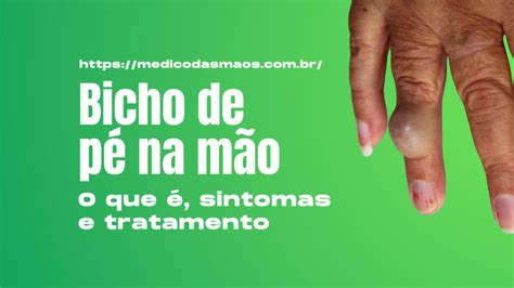 Bicho de pé na mão: O que é, sintomas e tratamento