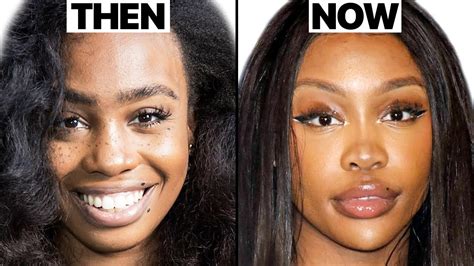 SZA New Face | Plastic Surgery Analysis - Oasis Medical Aesthetics