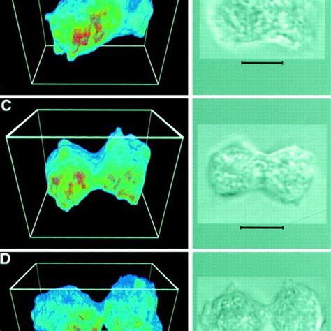 Shape changes of substrate attached D. discoideum cells. (A) Scanning ...