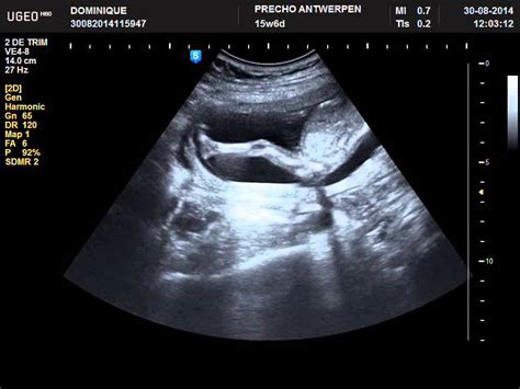 30 weeks pregnant 3d ultrasound - sayguy