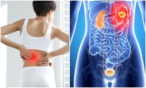 Back Pain Sign of Cancer - Could It Be a Cancer Warning? - Rebiz Zield