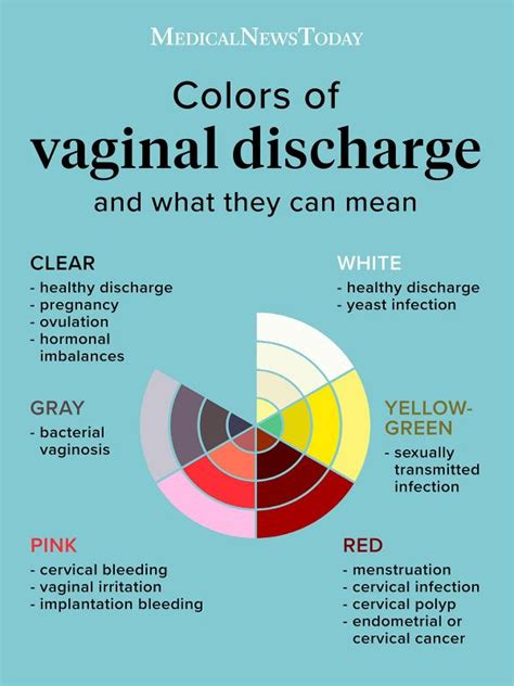 Vaginal discharge color guide: Causes and when to see a doctor