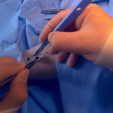 Surgical Skills - TeachMeSurgery