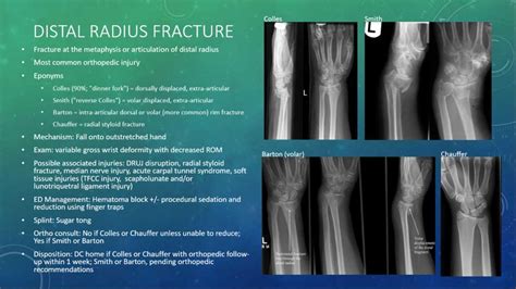 Reverse Sugar Tong Splint