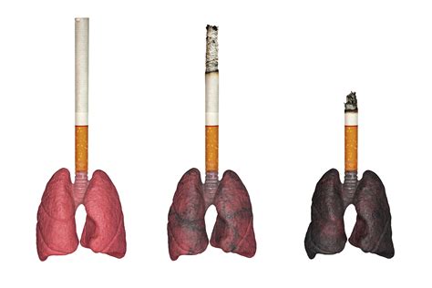 How to Help Lungs Recover After Quitting Smoking