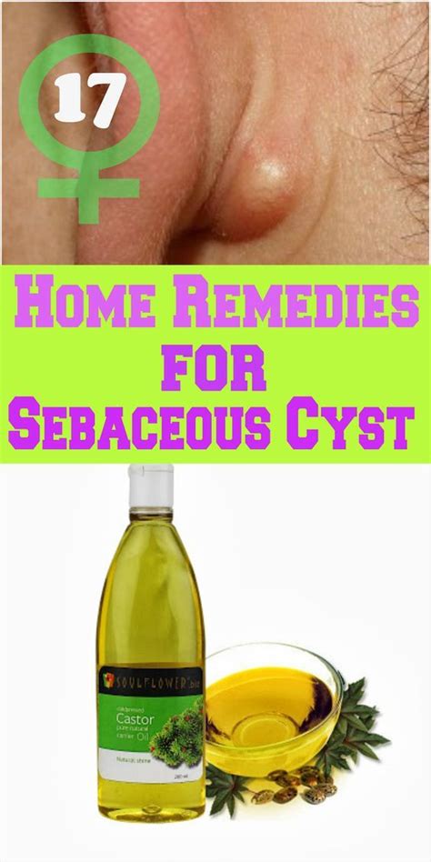 17 Home Remedies for Sebaceous Cyst | Natural health tips, Health ...