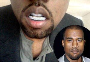 Kanye West Flashes Diamond Teeth: "The Diamonds Were Cooler" - TV Guide