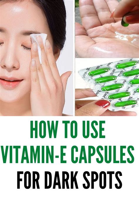 Benefits Of Vitamin E Capsules | How To Use For Skin and Hair ...