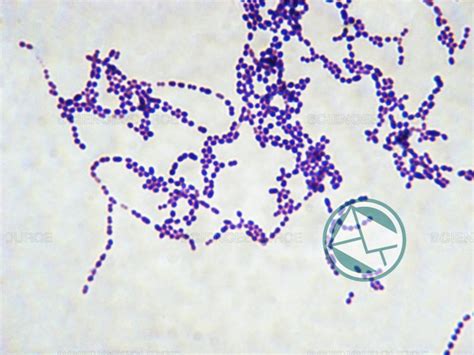 Infecciones causadas por la bacteria del estreptococo: Síntomas y ...