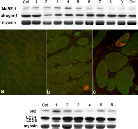 Biomolecular markers of muscle atrophy and autophagy. Upper panel shows ...