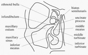 Ostiomeatal complex coronal | Epomedicine