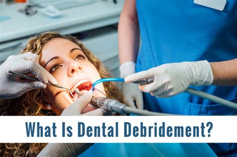 What is Dental Debridement | Riverside Dental