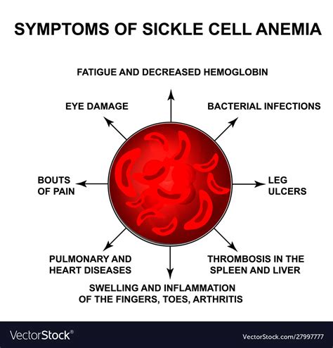 Symptoms sickle cell anemia world Royalty Free Vector Image