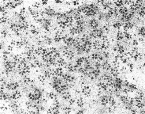 Ribosomes Electron Microscope