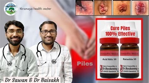 Top homeopathic medicine for piles- piles की रामबाण दवा- तुरंत राहत ...