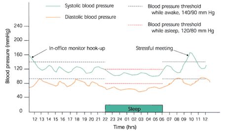 Reference Values For 24-Hour Ambulatory Blood Pressure, 41% OFF