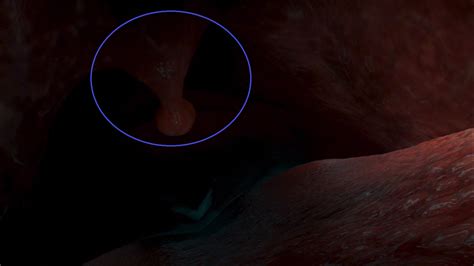 Image - Nemo whale uvula circled.png | Disney Wiki | FANDOM powered by ...