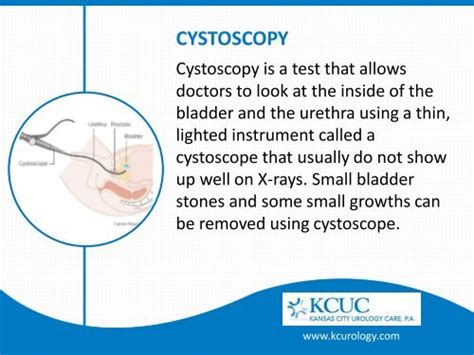 CYSTOSCOPY Cystos