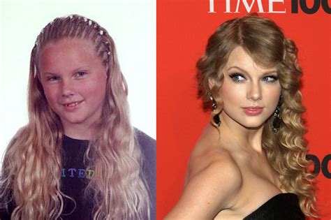 Taylor Swift Before and After Plastic Surgery