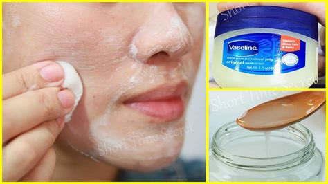 3 Days Overnight Pimples Treatment | World's best Pimple Treatment ...