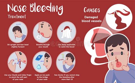 Nose Bleeding Cartoon Vector Stock Vector - Illustration of bleed ...