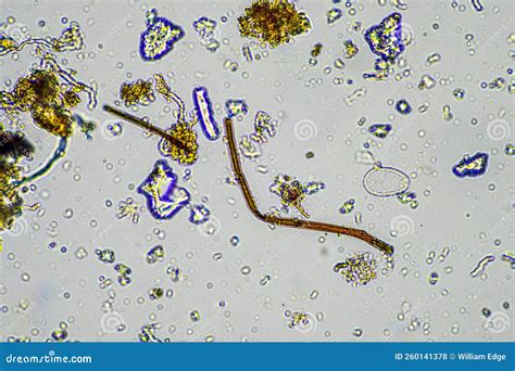 Soil Sample Under the Microscope. Soil Fungi and Microorganisms Cycling ...