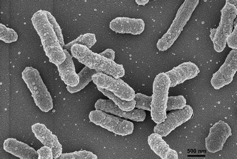 Yersinia pestis bacteria transmission, symptoms, diagnosis and treatment