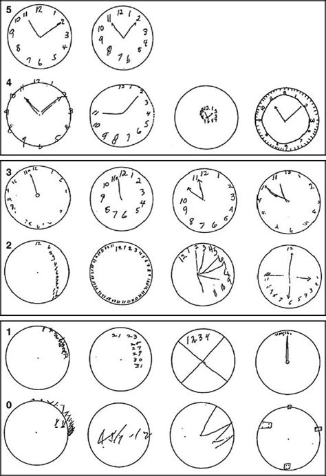 Dementia Clock Drawing at GetDrawings | Free download