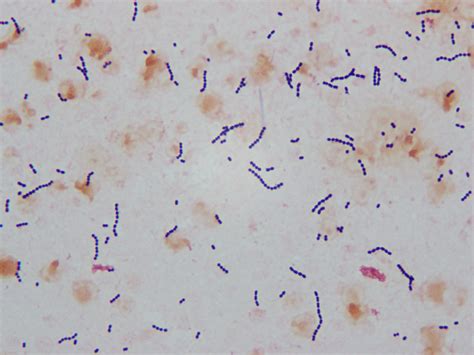 Streptococcus Bacteria Gram Stain