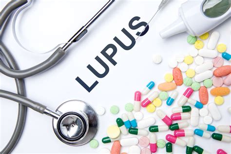 Lupus Treatments