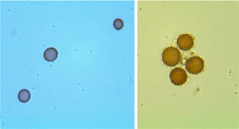 Mushroom Cell Under Microscope