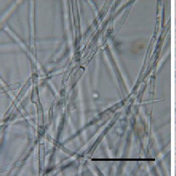 Macroscopic (a) and microscopic (b, c) morphology of Beauveria bassiana ...