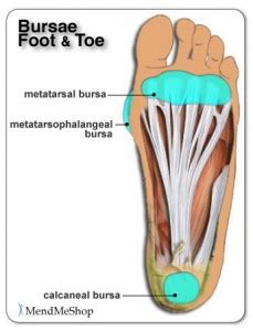 Bursitis Foot Treatment | Treatment For Foot Bursitis in Melbourne