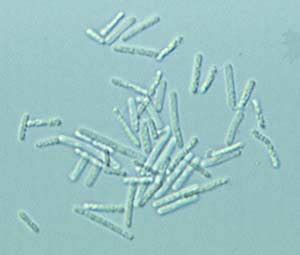 Microbiology: Lactobacillus