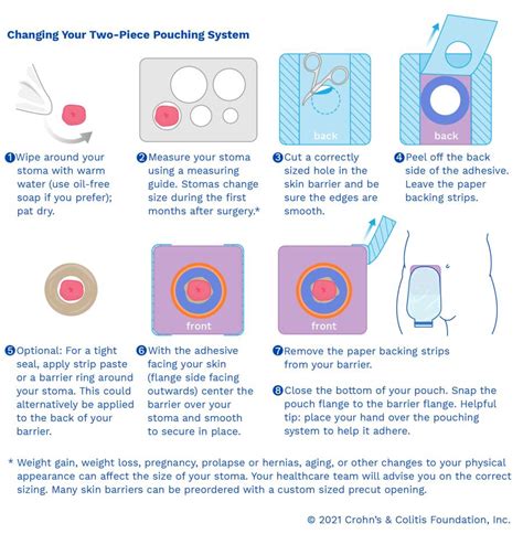 Ileostomy Bag Vs Colostomy Bag