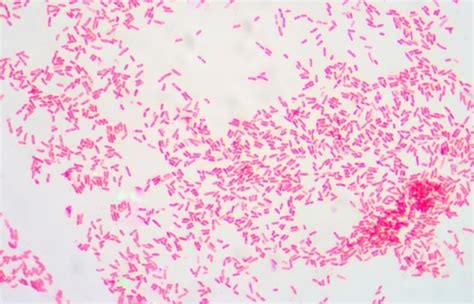 Novel Antimicrobial Agent Shows Promise Against Gram-Negative Bacteria ...