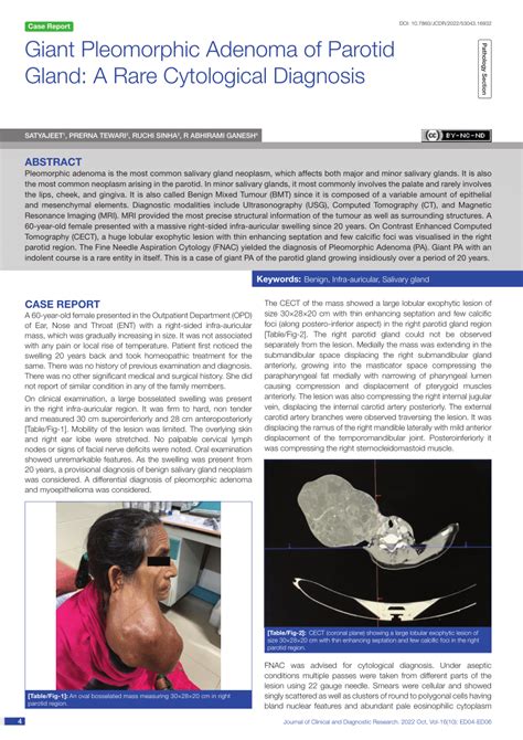 (PDF) Giant Pleomorphic Adenoma of Parotid Gland: A Rare Cytological ...