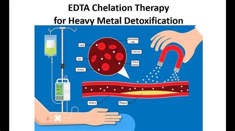 EDTA Chealation Therapy - Benefits, Uses & Side Effects