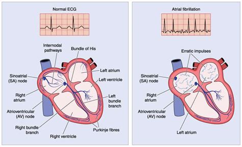 Heart Skipped A Beat? Here’s why it’s not as romantic as it sounds