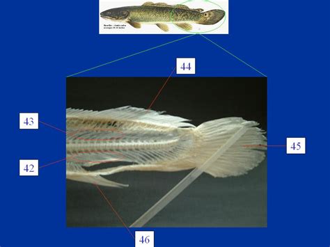 Axial Skeleton 2