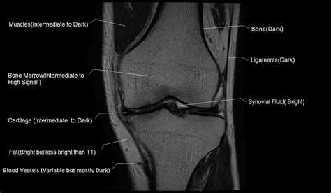 T1 vs T2 MRI | T1and T2 MRI image comparison