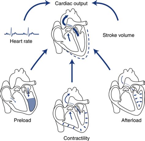 Cardiac Output Measurement | Clinical Gate