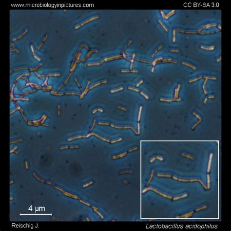 Lactobacillus acidophilus and cell morphology. Lactobacillus ...