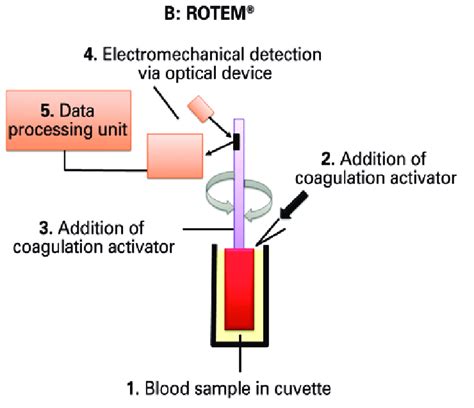 Working principle behind ROTEM ® | Download Scientific Diagram