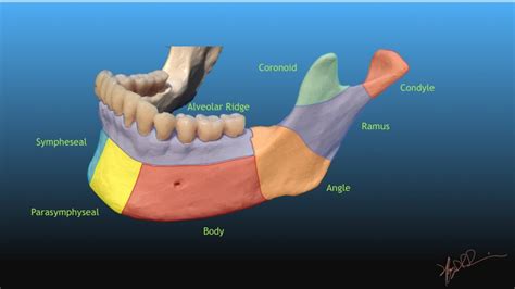 Dingman and Natvig Classification of Mandibular fractures | UW ...