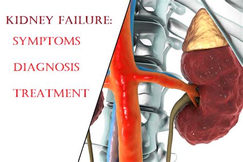 Kidney Failure: Symptoms, Diagnosis and Treatment - LivGastro LivGastro