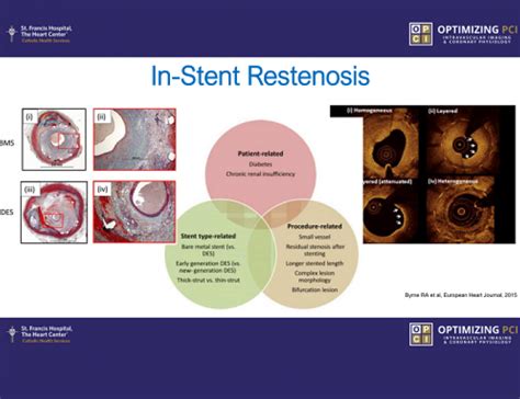 Stent failures – Identifying causes of stent thrombosis and restenosis ...